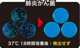 肺炎かん菌検査結果